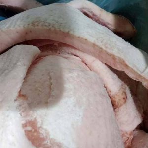 Mỡ Heo Cắt Tönnies Nhập Khẩu Đức Thùng 20kg Đông Lạnh